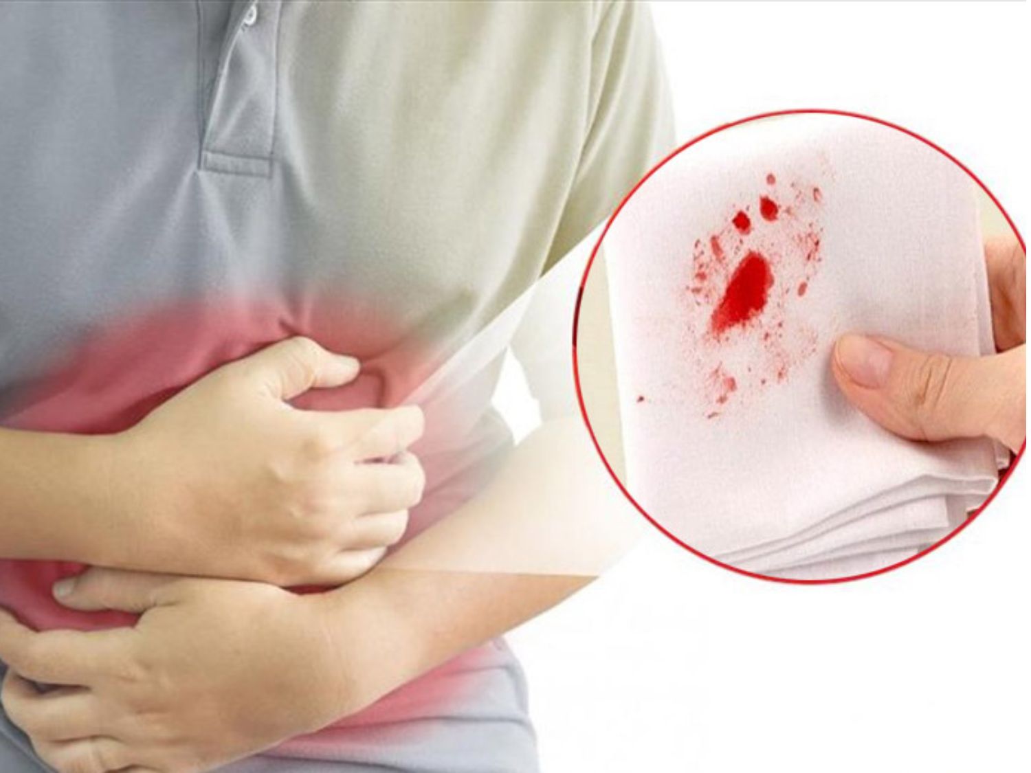 Đau dạ dày kèm nôn ra máu tươi, nhiều thì nên đi bệnh viện ngay lập tức