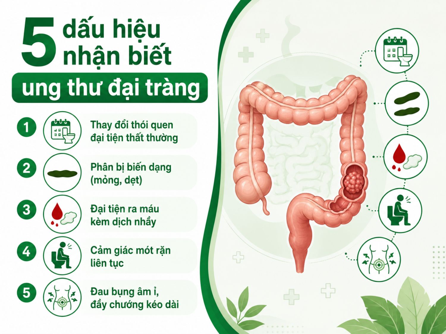 Nhận biết sớm 5 biểu hiện bất thường có thể liên quan đến ung thư đại tràng.
