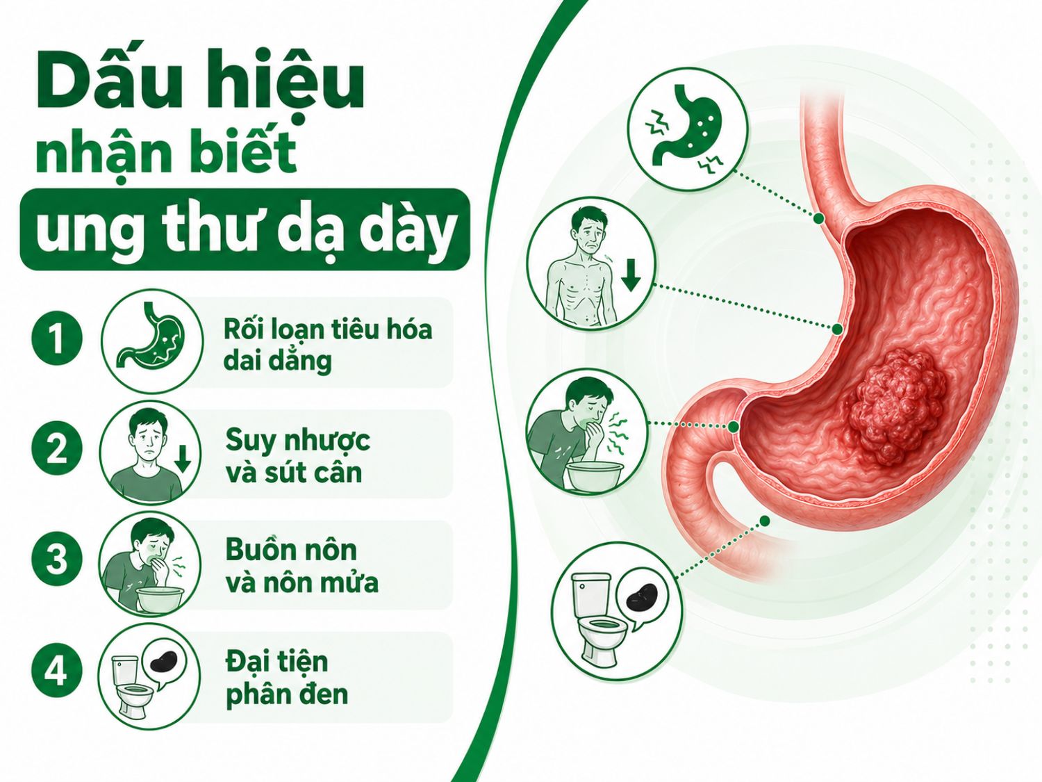 Các biểu hiện như rối loạn tiêu hóa kéo dài, sụt cân nhanh, buồn nôn, nôn mửa hoặc đi ngoài phân đen có thể là dấu hiệu cảnh báo bất thường ở dạ dày. Người bệnh nên thăm khám sớm nếu triệu chứng lặp lại hoặc ngày càng nặng.