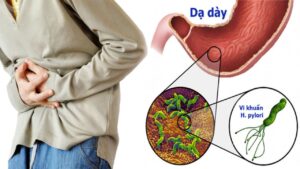 5 Dấu hiệu nhiễm vi khuẩn HP dạ dày dễ nhận biết và cách chẩn đoán chính xác