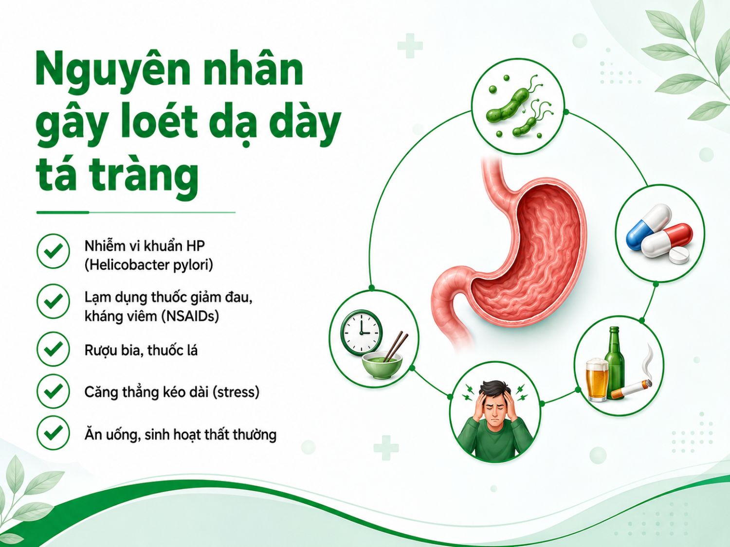 Loét dạ dày tá tràng có thể xuất phát từ nhiều yếu tố như vi khuẩn HP, dùng thuốc NSAIDs kéo dài, rượu bia, thuốc lá, căng thẳng và thói quen ăn uống thiếu điều độ.