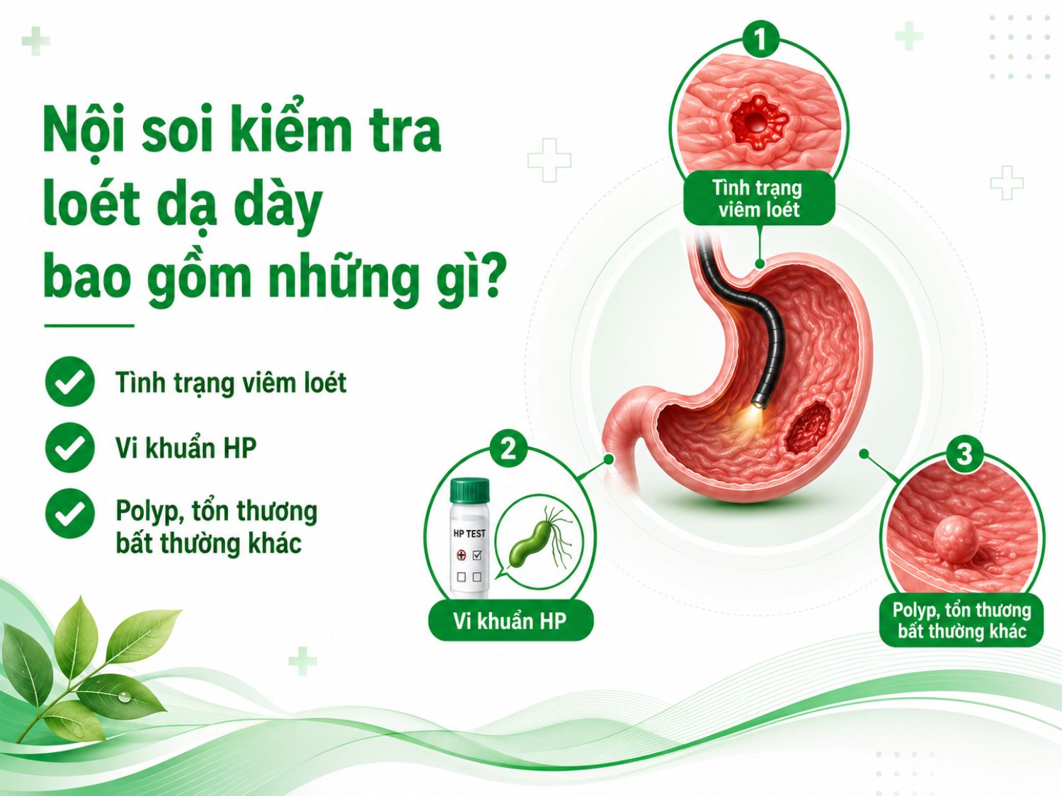 Nội soi dạ dày giúp bác sĩ quan sát trực tiếp niêm mạc, đánh giá ổ viêm loét, kiểm tra vi khuẩn HP và phát hiện polyp hoặc tổn thương bất thường để có hướng điều trị phù hợp.