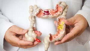 Táo bón mạn tính là gì? Dấu hiệu, nguyên nhân và cách xử lý