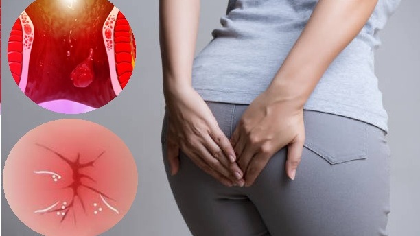 Đau hậu môn kèm theo tiết dịch hoặc có mùi khó chịu