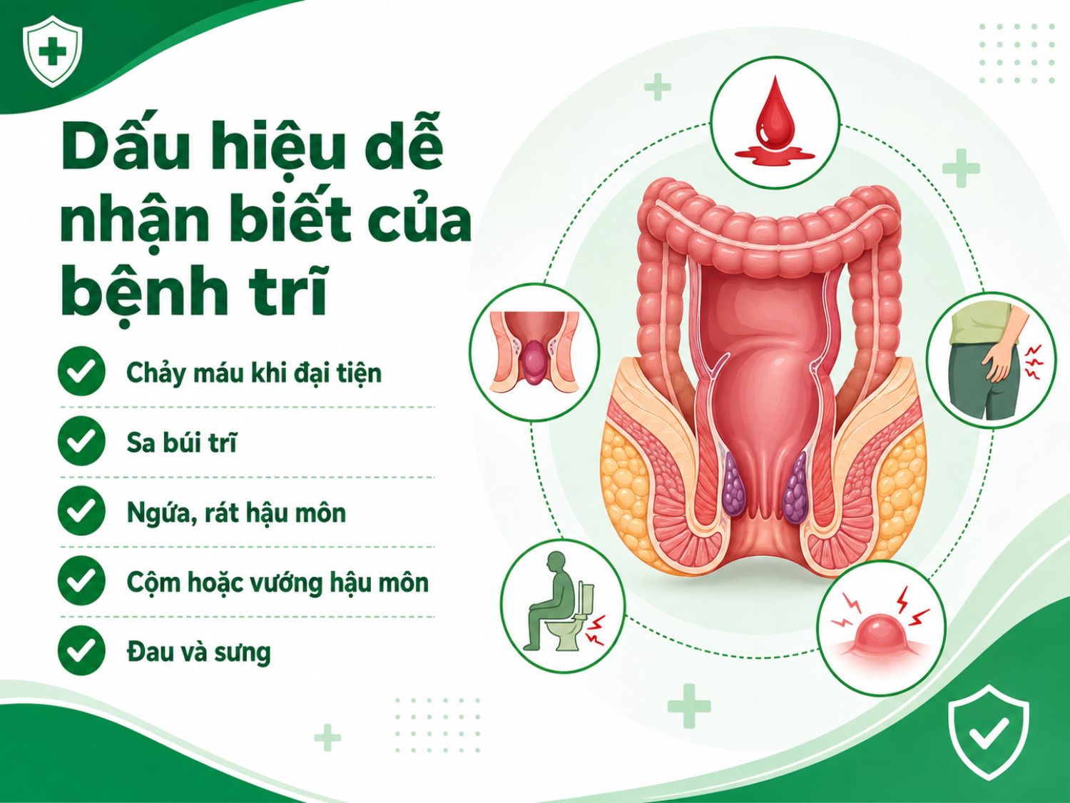 Bệnh trĩ thường gây chảy máu khi đi ngoài, sa búi trĩ, ngứa rát, cảm giác cộm vướng và đau sưng vùng hậu môn.