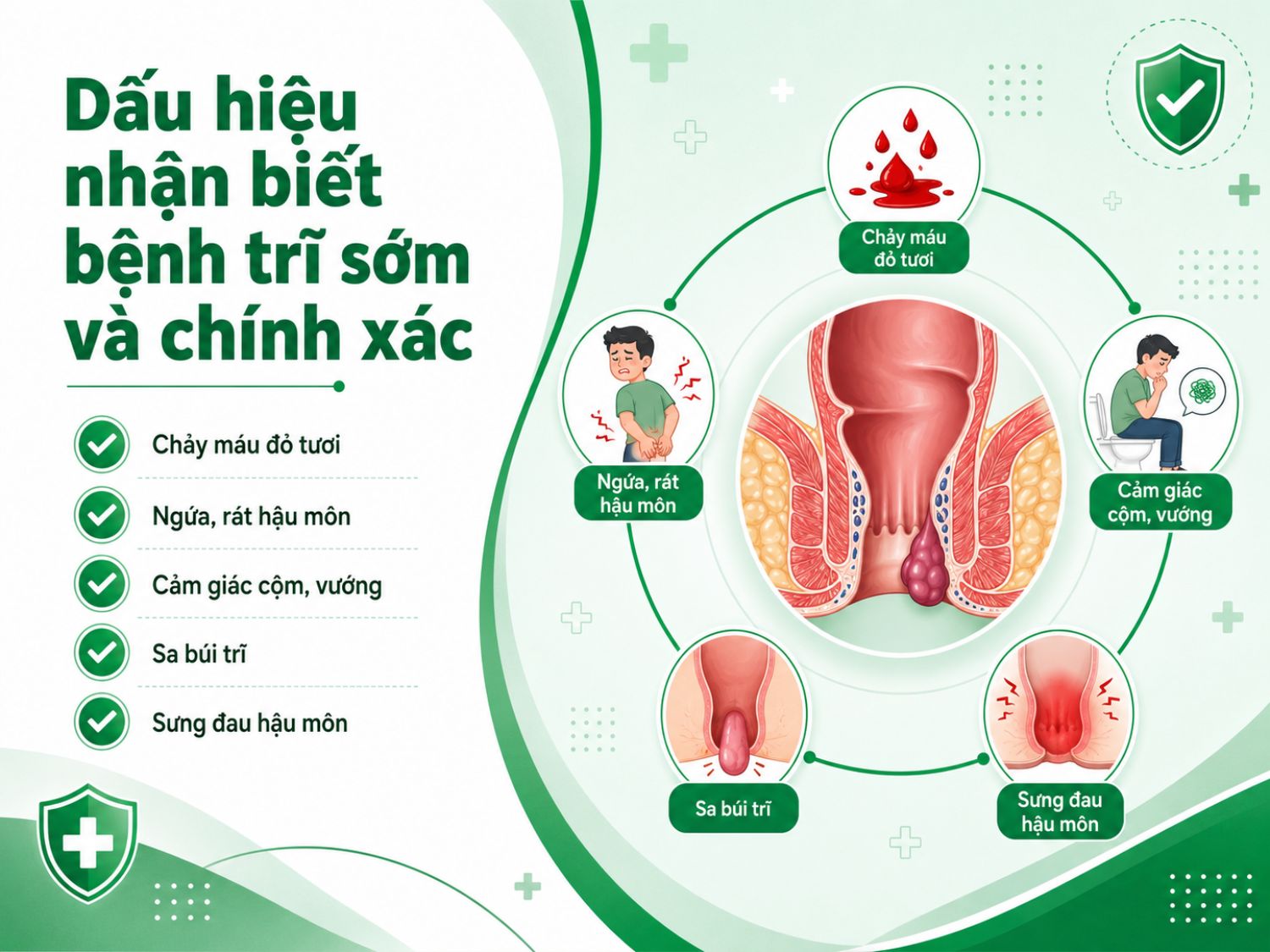 Bệnh trĩ giai đoạn sớm thường biểu hiện bằng chảy máu khi đại tiện, ngứa rát, cảm giác cộm vướng và có thể xuất hiện búi trĩ sa hoặc sưng đau.
