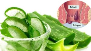 Mẹo chữa trĩ tại nhà có hiệu quả không? Bác sĩ giải đáp