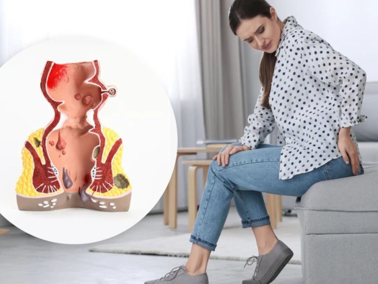 Phụ nữ có thể bị trĩ do táo bón, mang thai, sinh con hoặc tăng áp lực vùng chậu, gây đau rát, cộm vướng và khó chịu khi ngồi hoặc đại tiện.