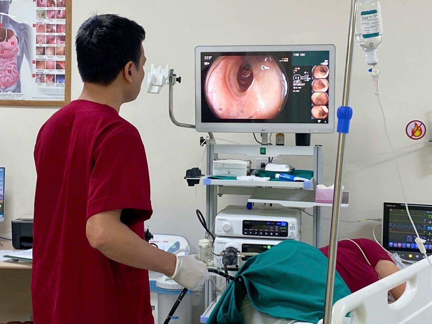 Nội soi sẽ giúp bác sĩ phát hiện được mức độ trĩ nội
