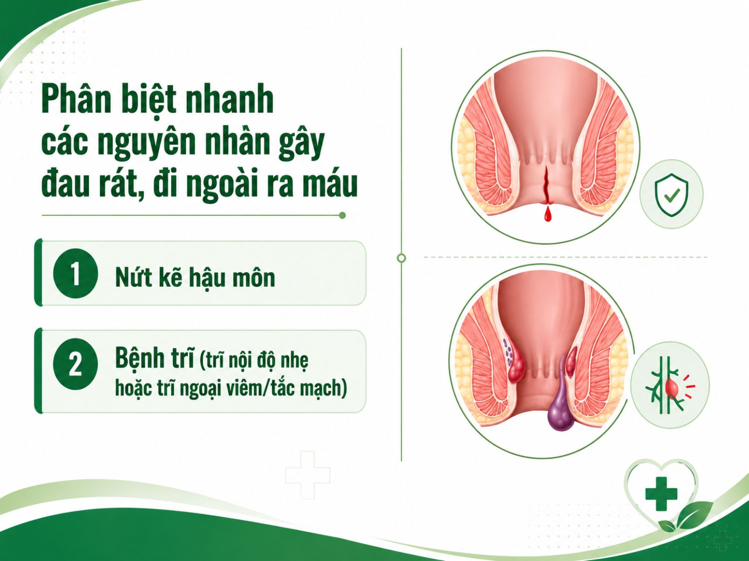 Nứt kẽ hậu môn thường gây đau rát rõ khi đại tiện, trong khi bệnh trĩ có thể kèm búi trĩ, sưng đau và chảy máu.