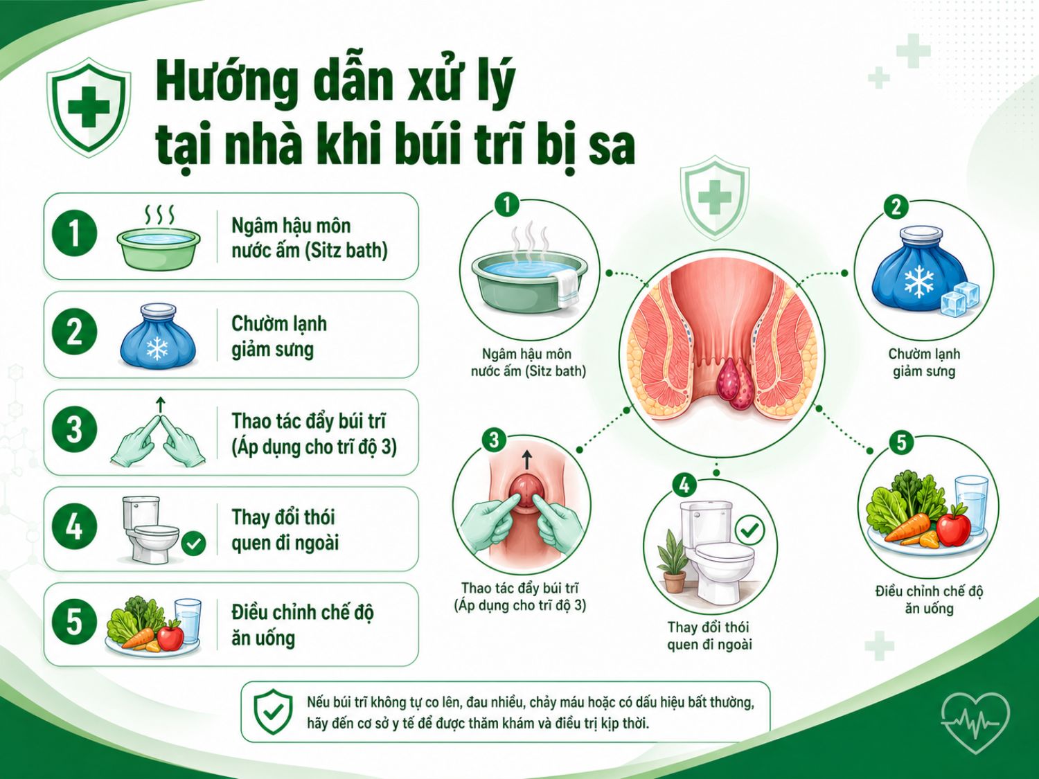 Khi búi trĩ bị sa, có thể ngâm hậu môn bằng nước ấm, chườm lạnh giảm sưng, tăng chất xơ và thay đổi thói quen đi ngoài để hỗ trợ giảm khó chịu.