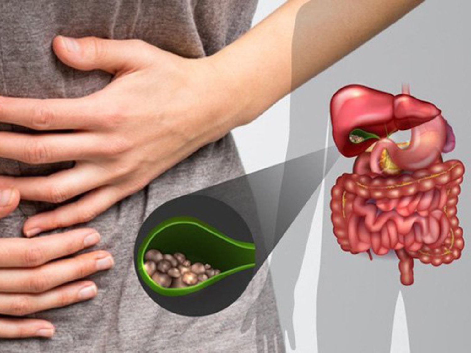 Các bệnh lý sỏi mật, bệnh tuyến tụy có thể gây đầy bụng khó chịu