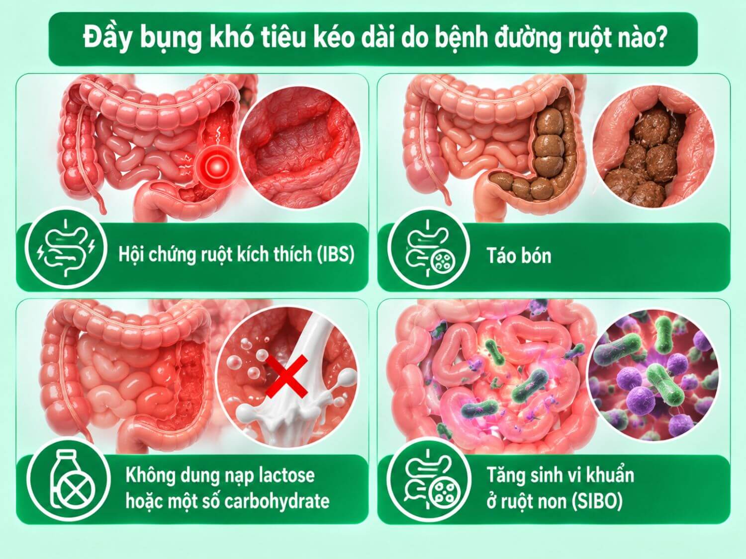 Một số nguyên nhân đường ruột gây đầy bụng, khó tiêu kéo dài gồm hội chứng ruột kích thích, táo bón, không dung nạp lactose hoặc carbohydrate và tăng sinh vi khuẩn ruột non (SIBO).