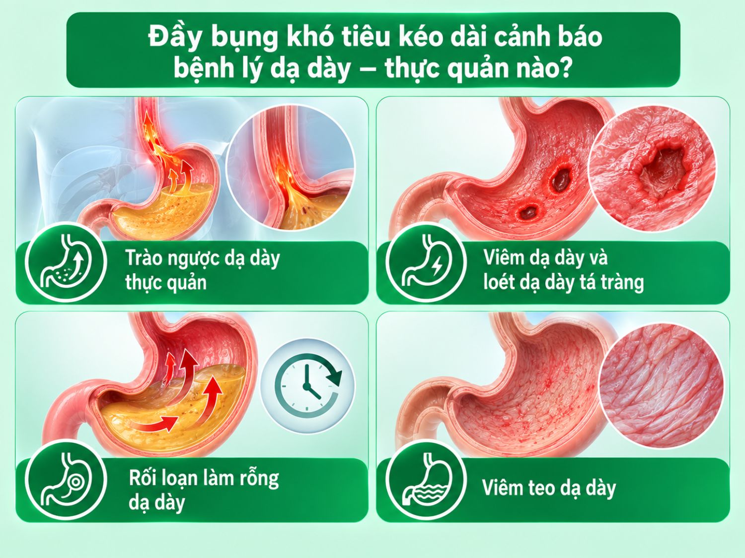 Đầy bụng, khó tiêu kéo dài có thể liên quan đến trào ngược dạ dày thực quản, viêm – loét dạ dày tá tràng, rối loạn làm rỗng dạ dày hoặc viêm teo dạ dày.