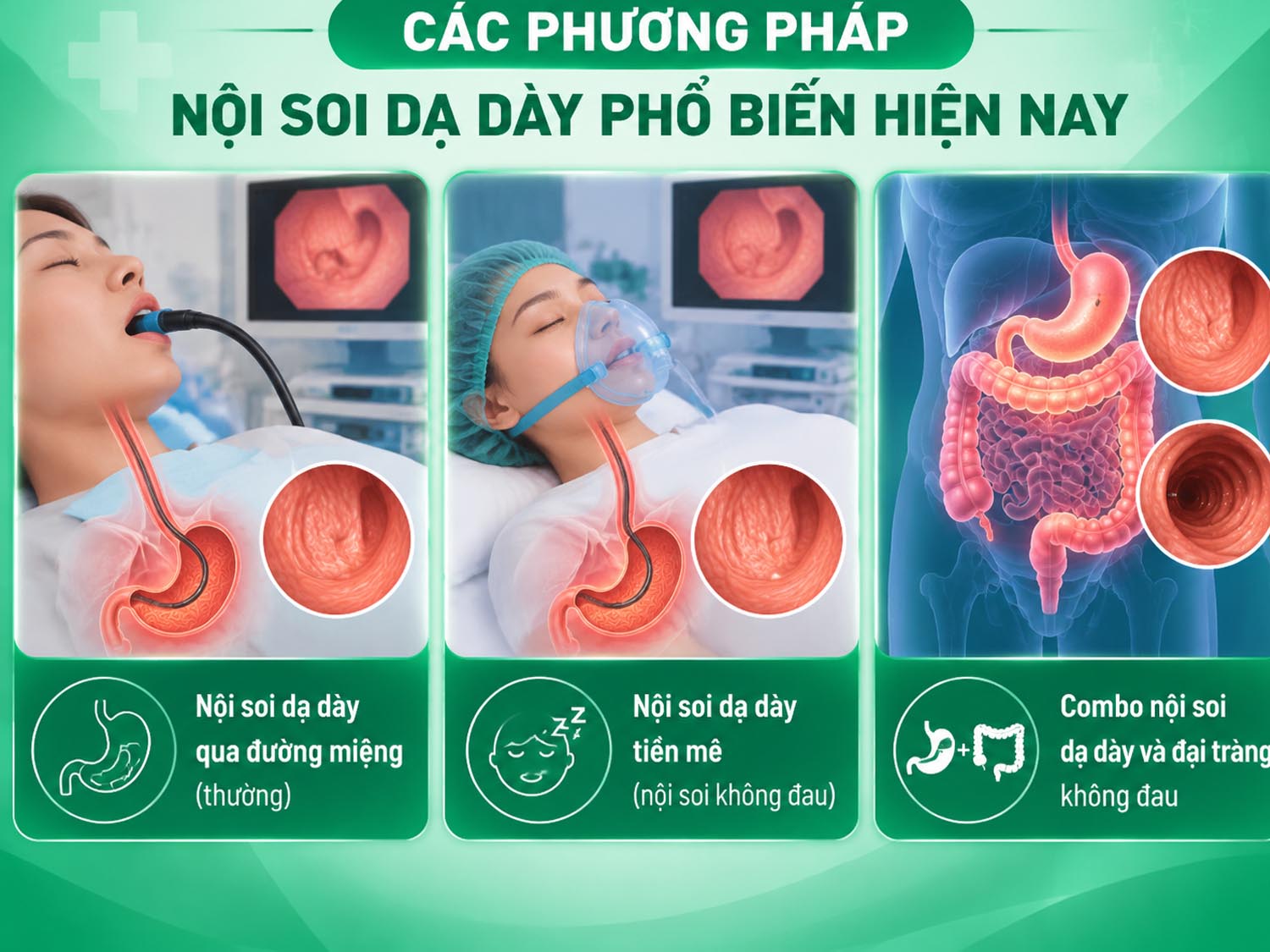 các phương pháp nội soi dạ dày gồm nội soi thường, nội soi không đau và combo kiểm tra dạ dày – đại tràng trong cùng một lần thực hiện