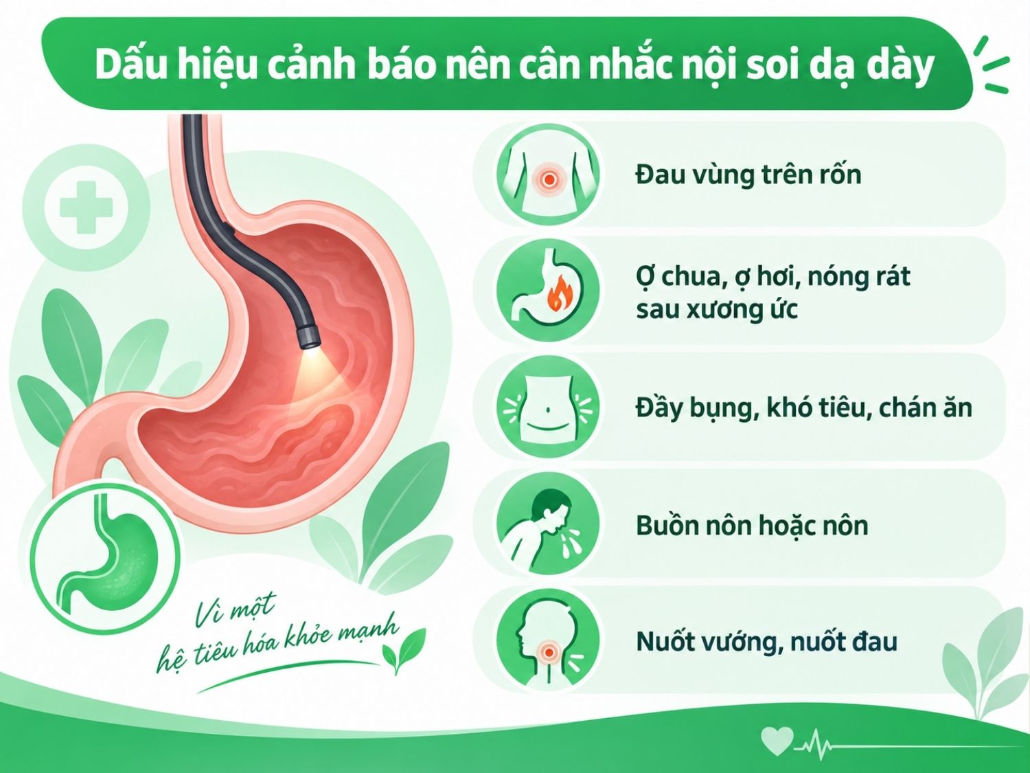 Dấu hiệu cảnh báo nên cân nhắc nội soi dạ dày gồm đau vùng trên rốn, ợ chua, đầy bụng
