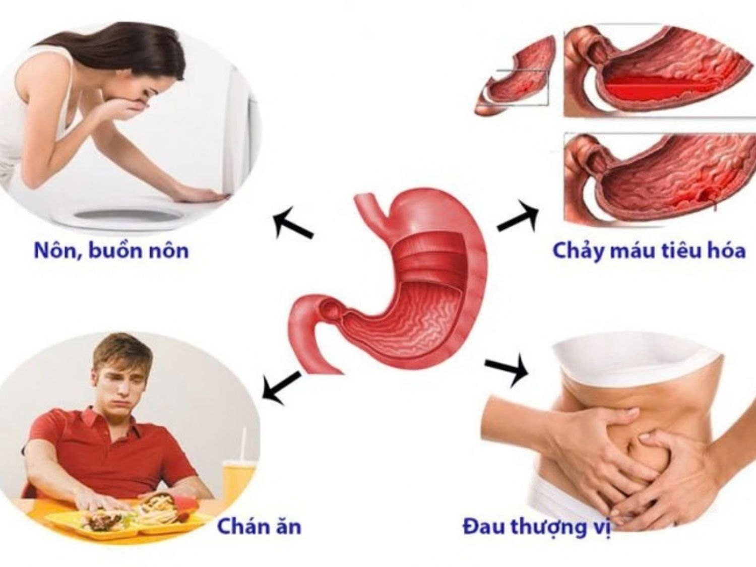 Triệu chứng chảy máu tiêu hoá, nôn nhiều cần đi khám ngay