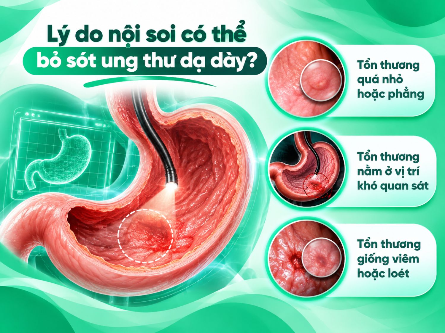 Chi phí xét nghiệm và điều trị HP phụ thuộc vào phương pháp thực hiện, nhu cầu sinh thiết hoặc can thiệp, mục đích xét nghiệm, chi phí khám tái khám và tình trạng đáp ứng điều trị.