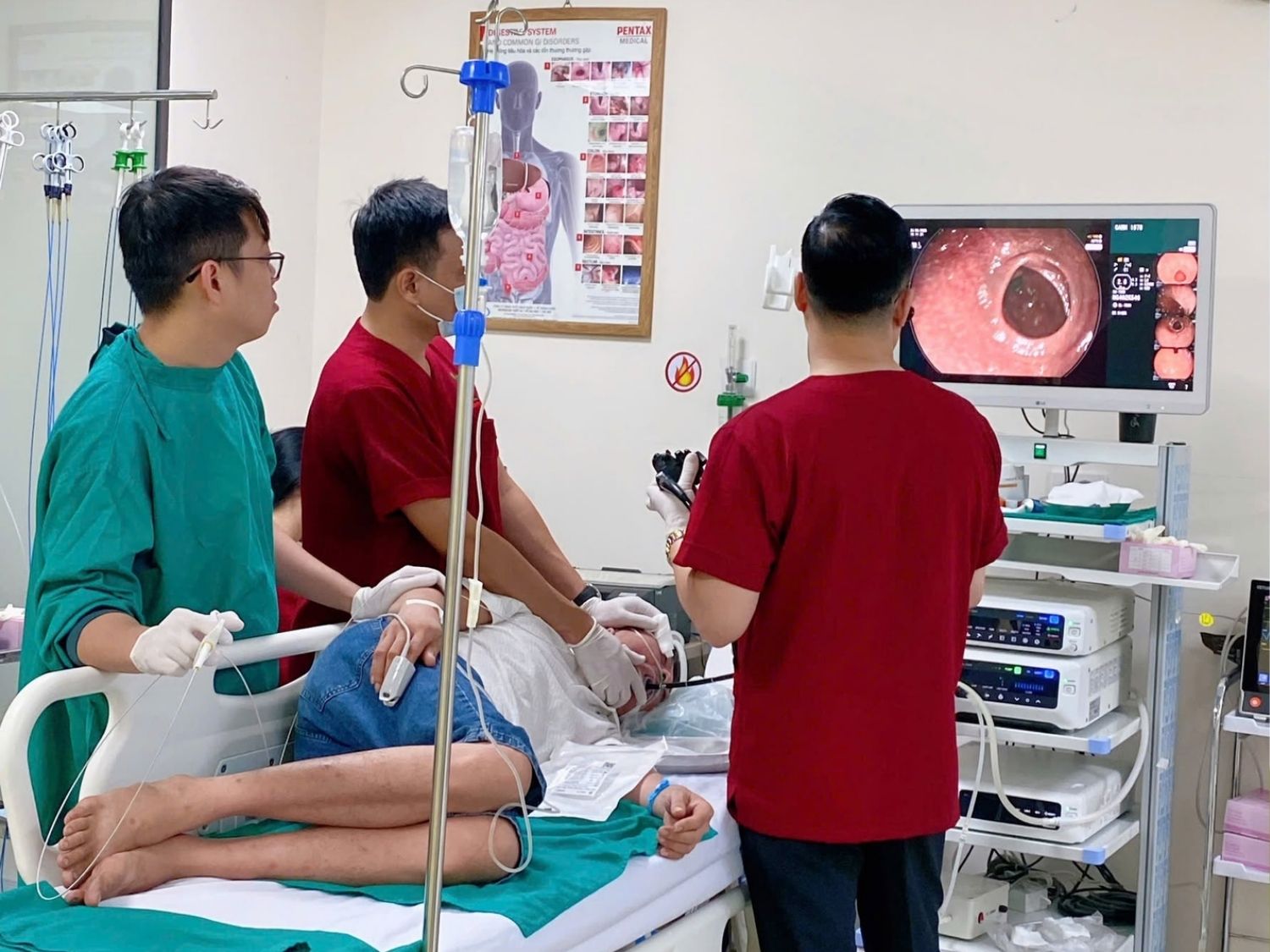 Nội soi không đau (nội soi tiền mê) tại Tiêu hóa Việt