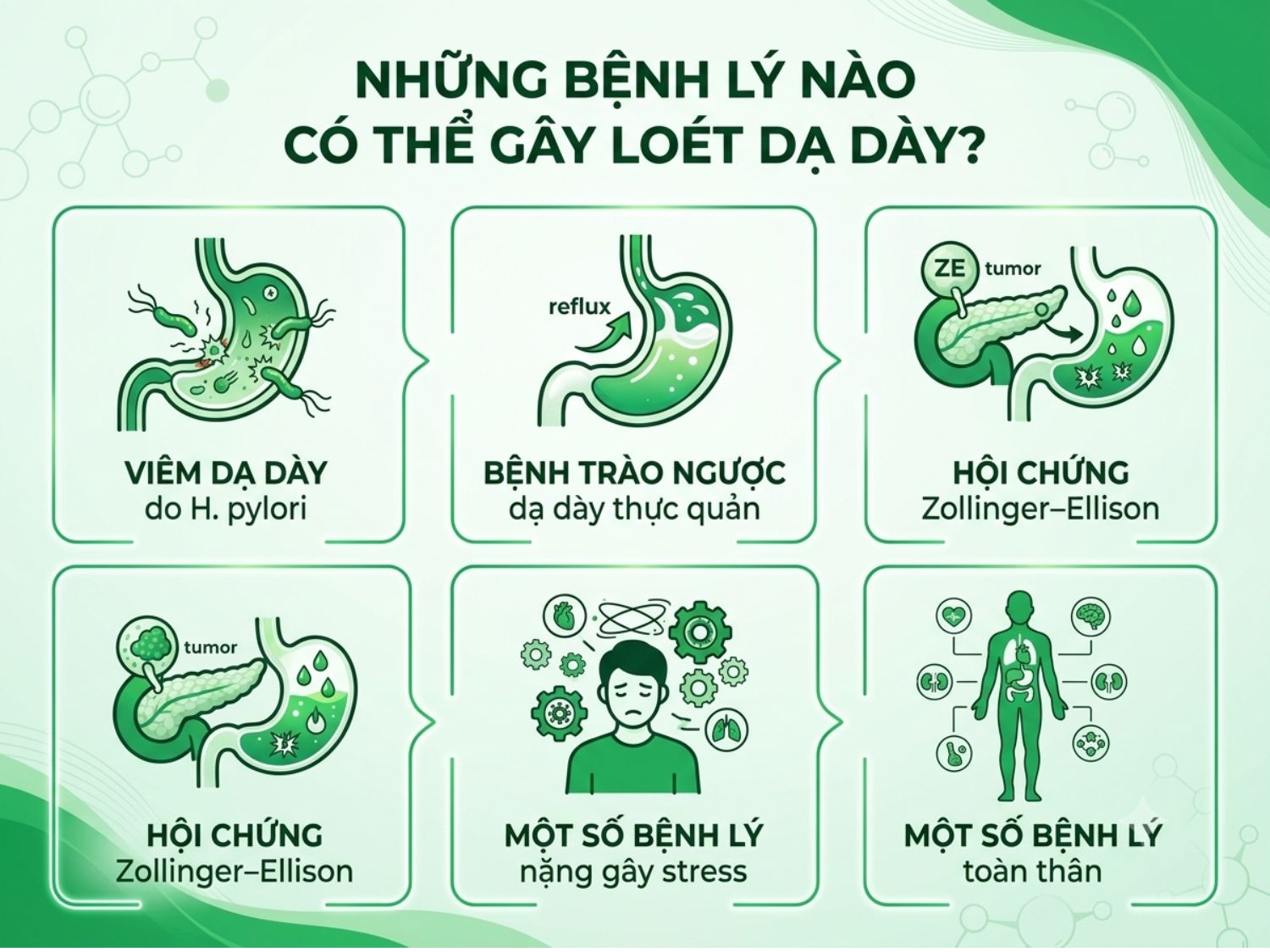 Khám phá 5 nhóm bệnh lý có thể dẫn đến loét dạ dày: viêm dạ dày do H. pylori, bệnh trào ngược dạ dày thực quản (GERD), hội chứng Zollinger–Ellison, các bệnh lý nặng gây stress cho cơ thể, và một số bệnh lý toàn thân khác. Việc chẩn đoán và điều trị chính xác các bệnh lý này là rất quan trọng để ngăn ngừa loét dạ dày.
