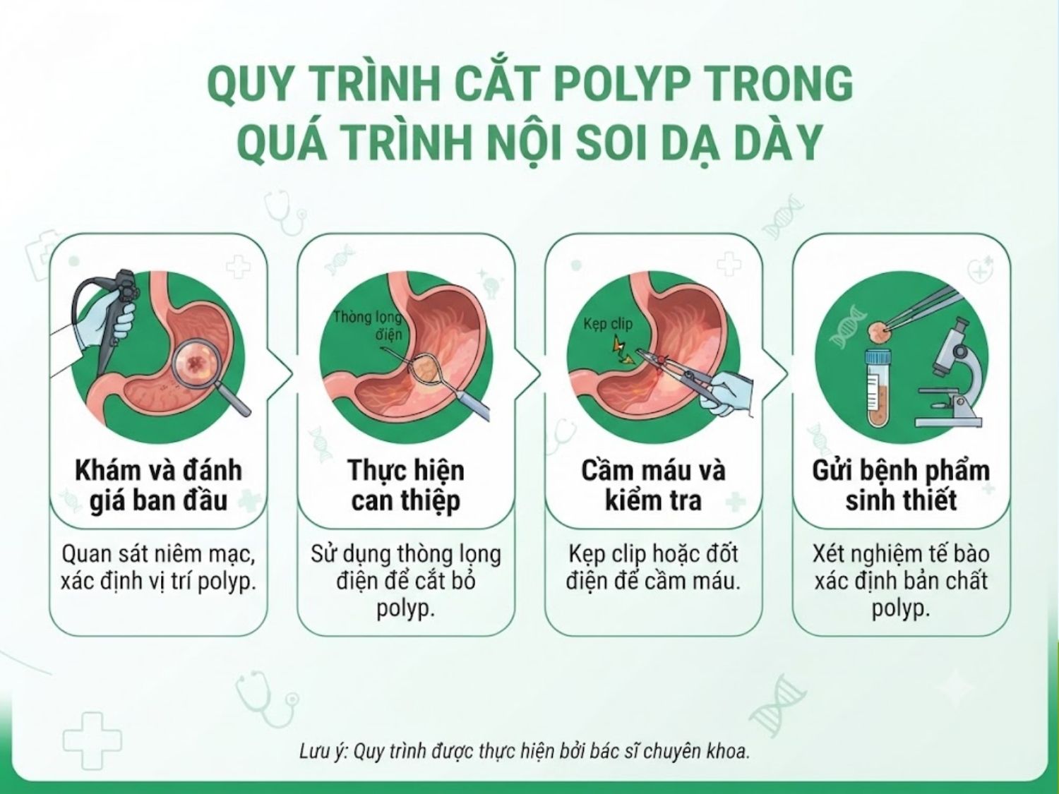 Quy trình cắt polyp trong quá trình nội soi dạ dày