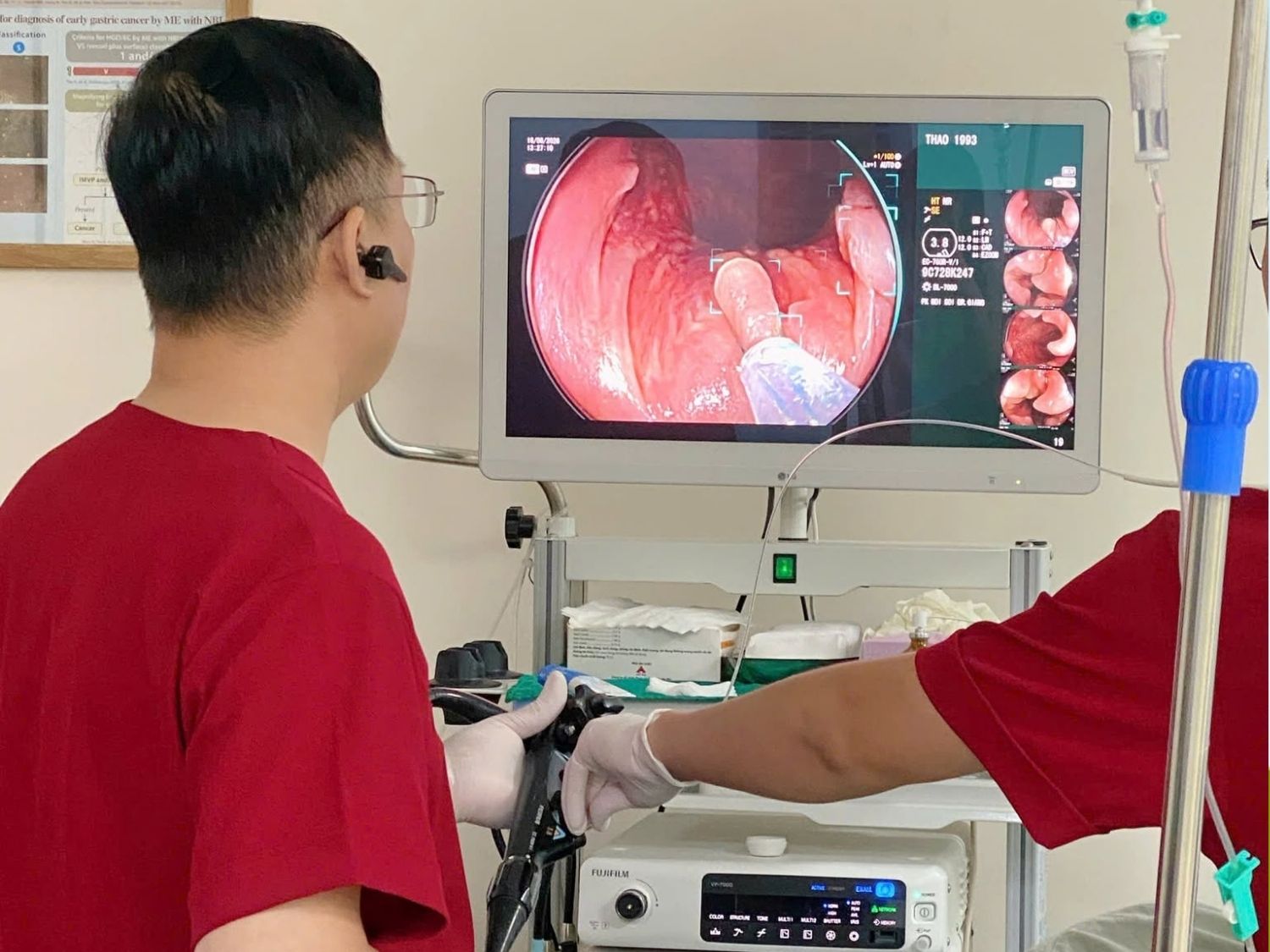 nội soi Giúp loại bỏ polyp kịp thời