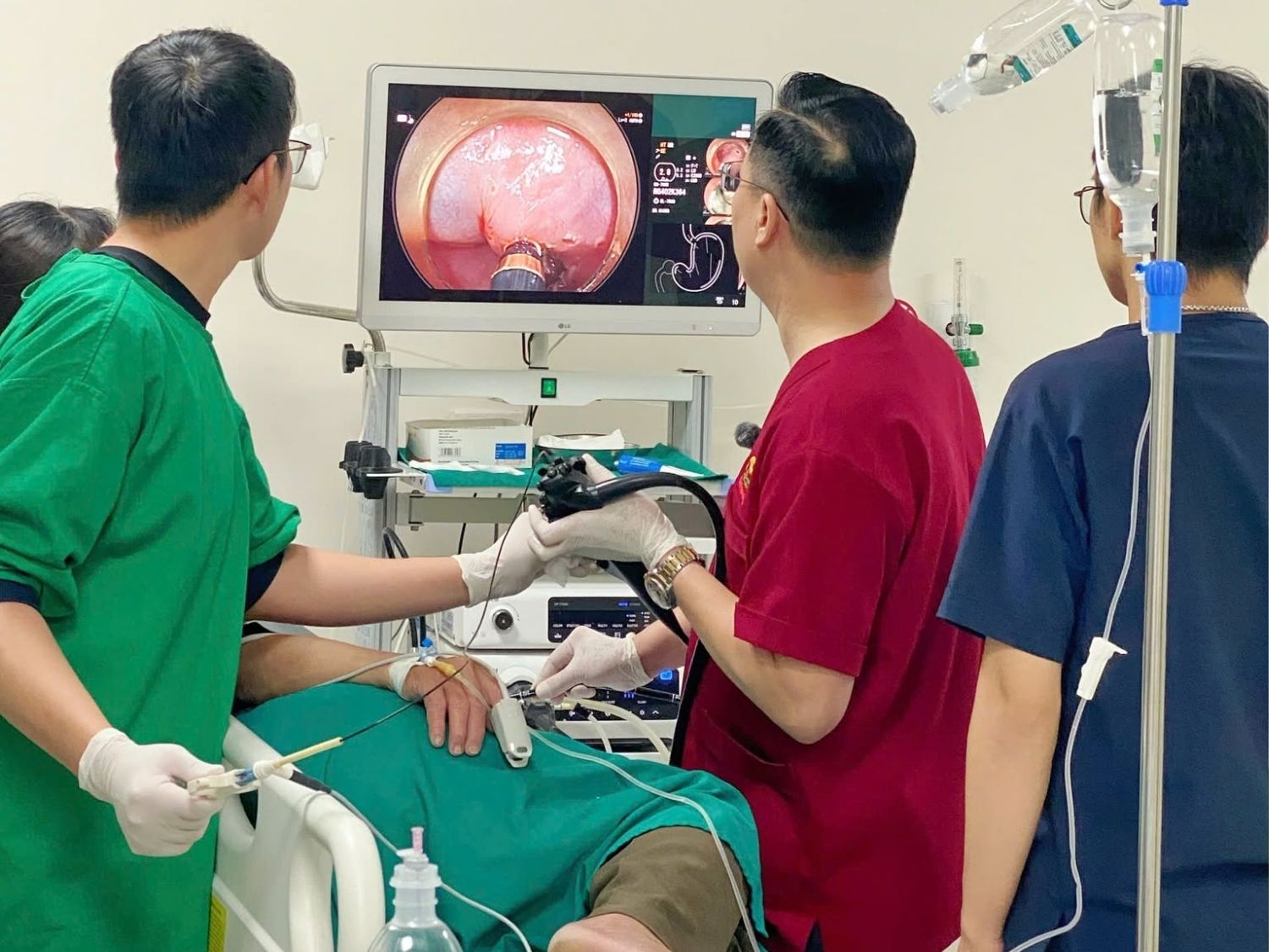 Nội soi dạ dày là kỹ thuật giúp bác sĩ quan sát trực tiếp thực quản, dạ dày và tá tràng