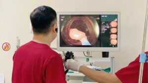 Nội soi dạ dày có nguy hiểm không, tỷ lệ biến chứng bao nhiêu?