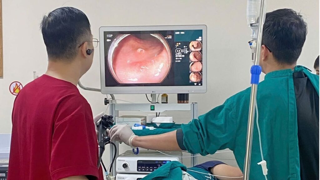 Nội soi dạ dày có phát hiện được ung thư không?