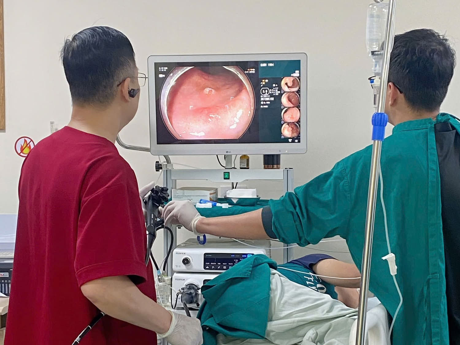 Nội soi giúp bác sĩ quan sát trực tiếp niêm mạc dạ dày để phát hiện vùng viêm, loét, polyp