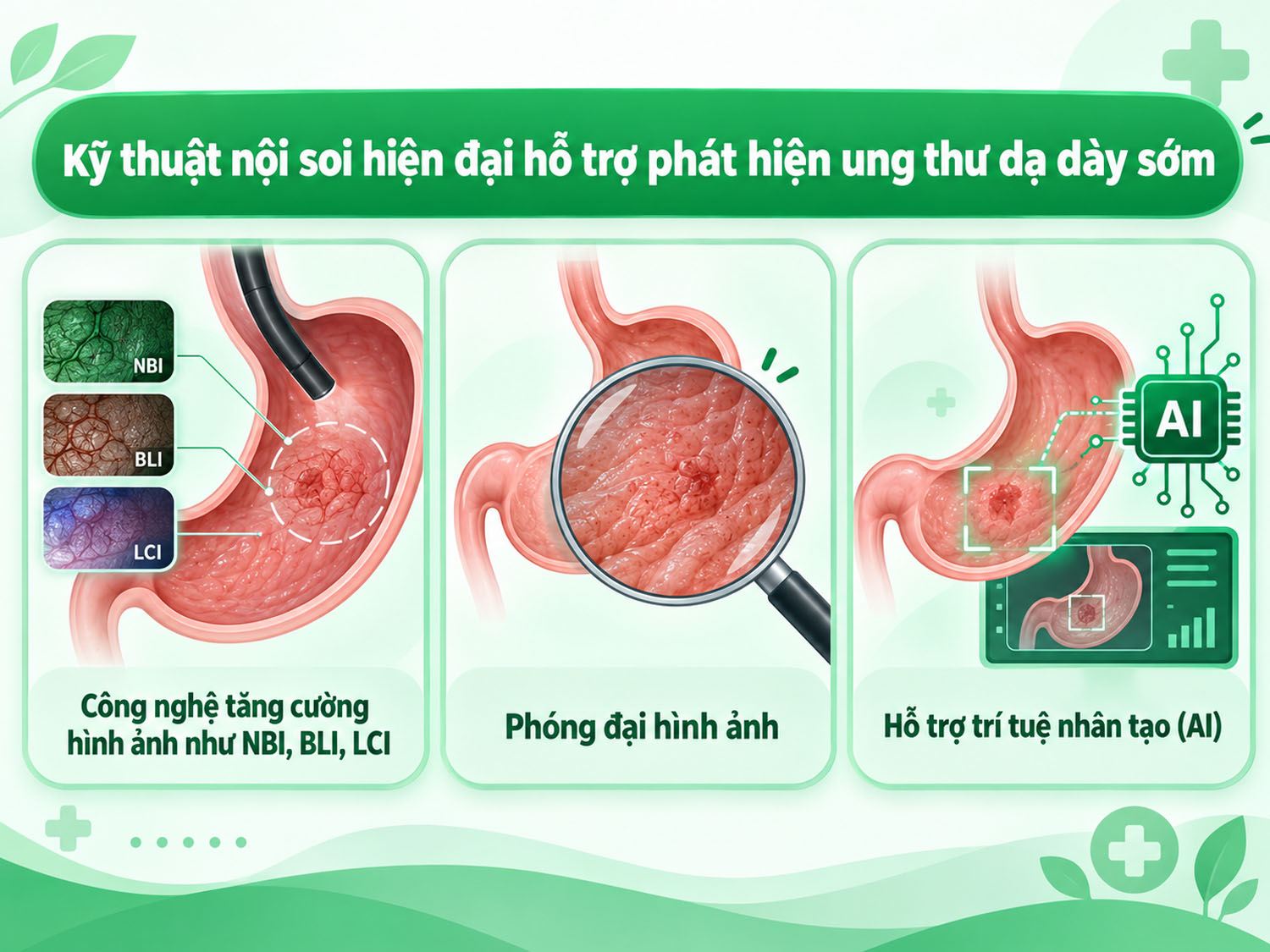 công nghệ hiện đại tăng cường hình ảnh như NBI, BLI, LCI khi nội soi dạ dày