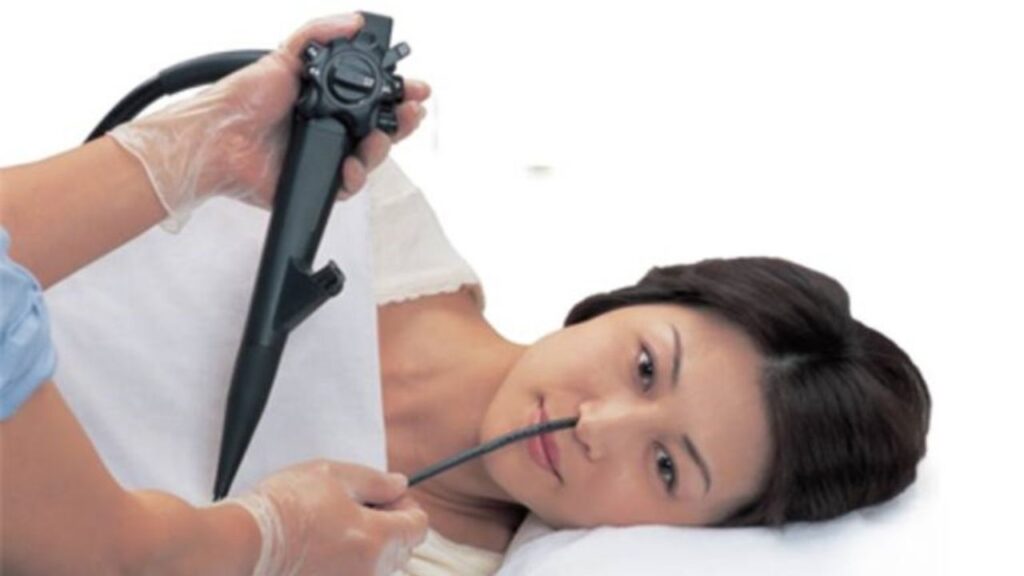 Nội soi dạ dày qua đường mũi có tốt hơn qua miệng không?