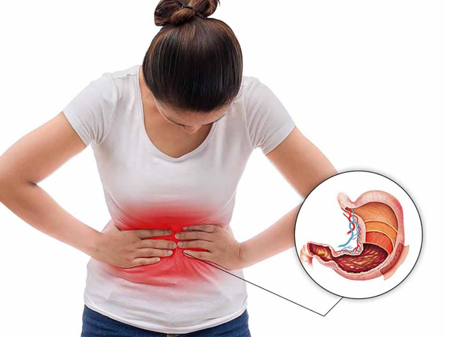 Polyp dạ dày có thể không gây triệu chứng; một số trường hợp có thể xuất hiện khó chịu hoặc đau vùng bụng và cần được kiểm tra khi triệu chứng kéo dài.