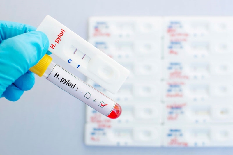 Quá trình nội soi kèm tets HPV thì chi phí sẽ tăng cao hơn