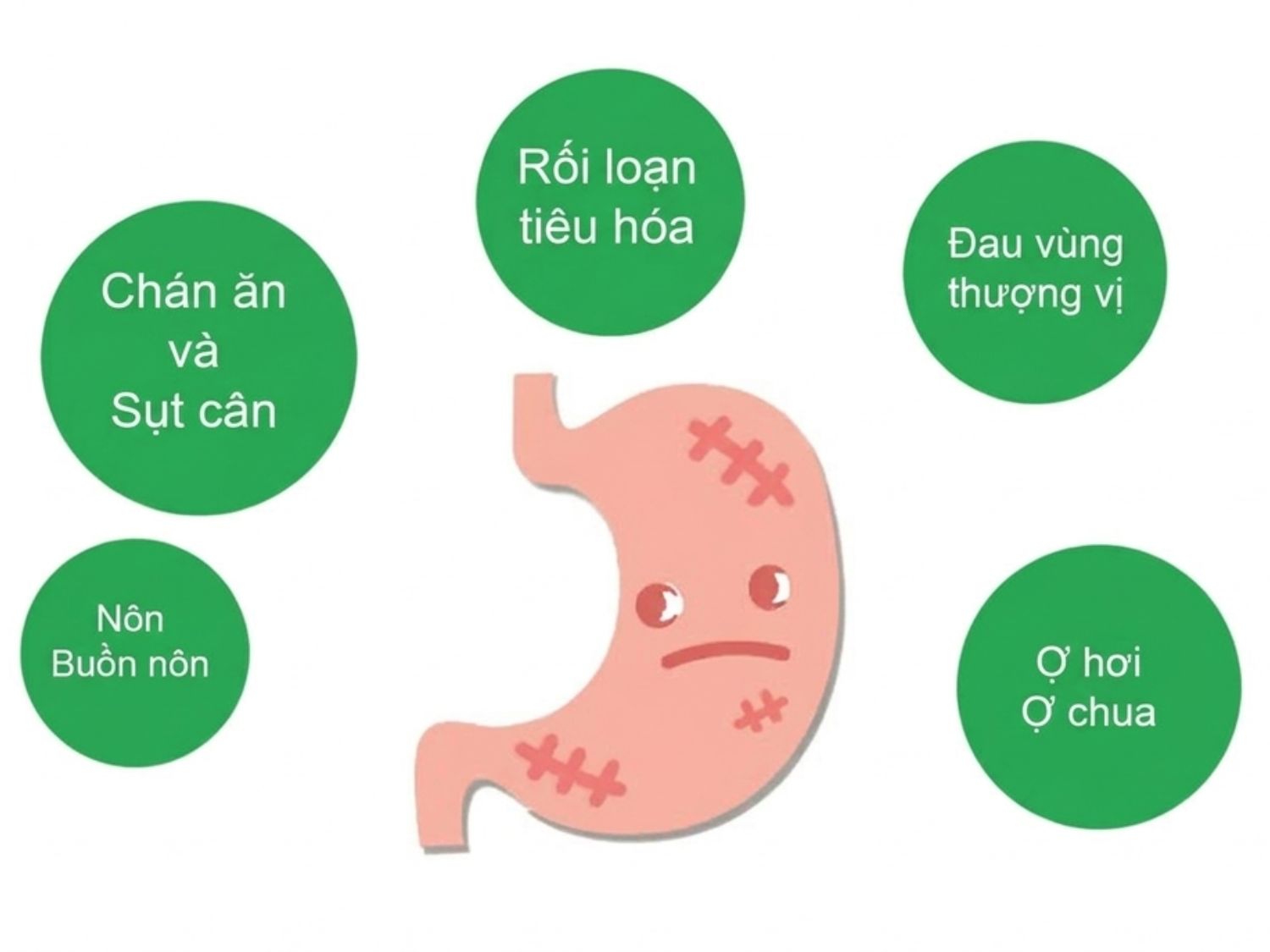Những triệu chứng nhận biết loét dạ dày gồm chán ăn, nôn, rối loạn tiêu hoá