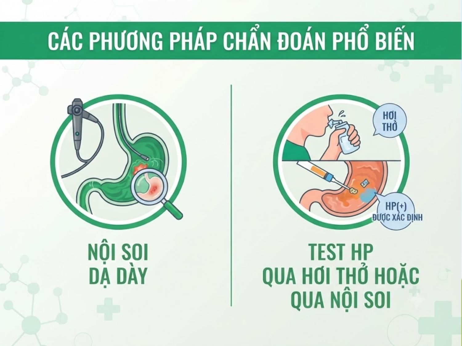 Nội soi dạ dày và test hp la phương pháp chẩn đoán tốt