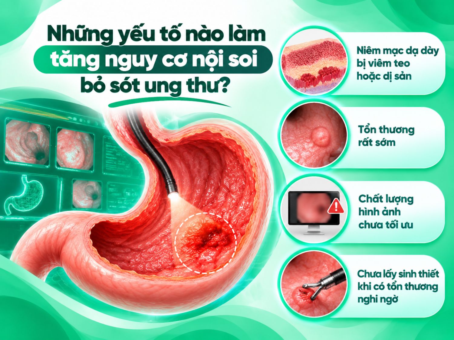 Một số yếu tố có thể làm tăng nguy cơ bỏ sót tổn thương khi nội soi như viêm teo hoặc dị sản niêm mạc, tổn thương rất sớm, hình ảnh chưa tối ưu hoặc chưa thực hiện sinh thiết khi có dấu hiệu nghi ngờ.