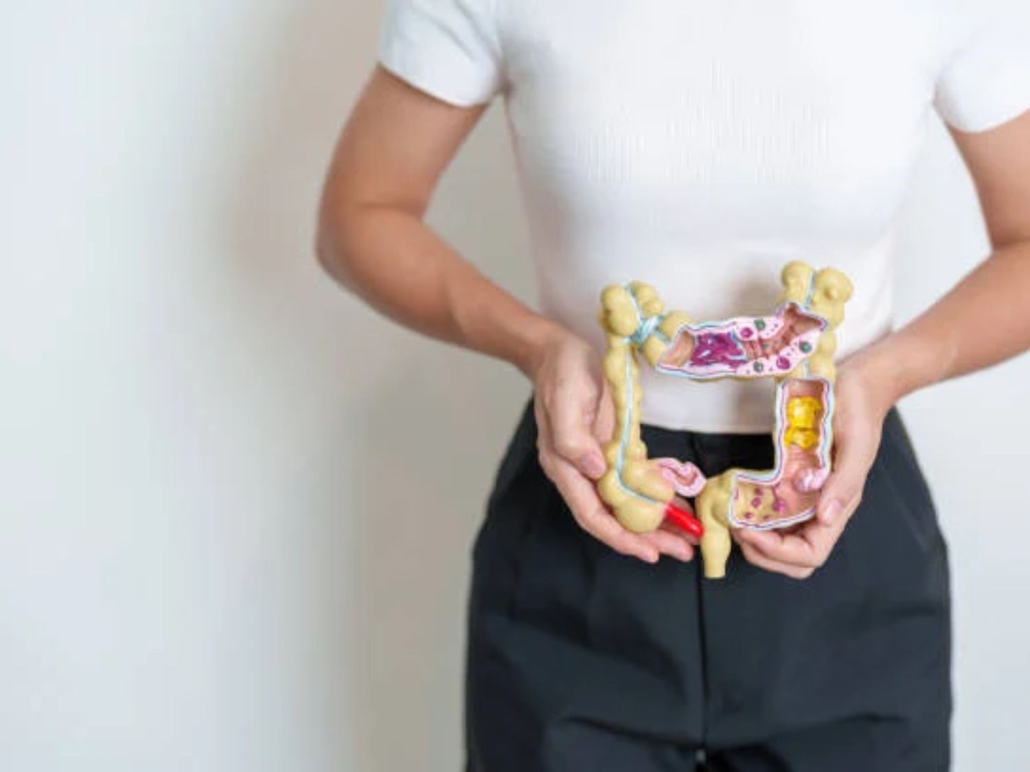 Ung thư đại trực tràng là sự hình thành các khối u ác tính ở phần ruột già