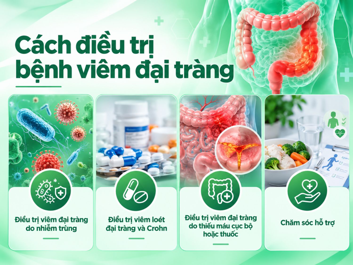 Phương pháp điều trị viêm đại tràng phụ thuộc vào nguyên nhân và mức độ tổn thương. Người bệnh có thể cần sử dụng thuốc theo chỉ định, điều trị nguyên nhân gây viêm và kết hợp chế độ ăn uống, sinh hoạt phù hợp để hỗ trợ hồi phục và kiểm soát triệu chứng.