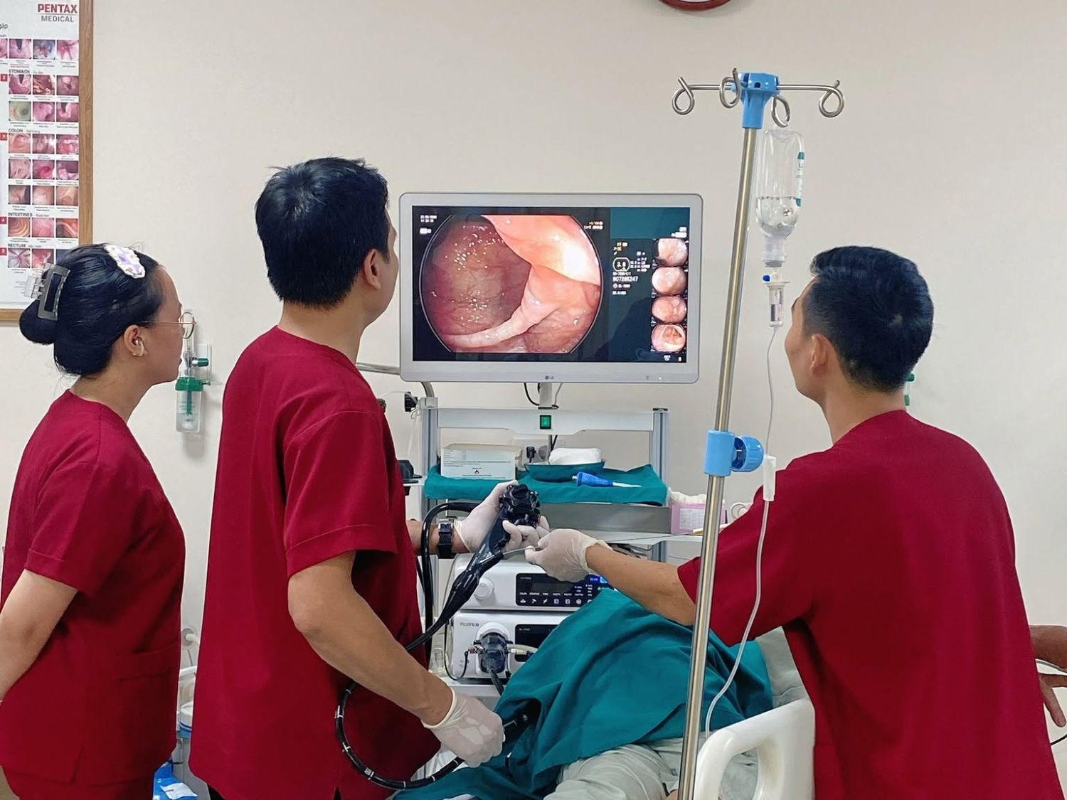 Nội soi đại tràng giúp bác sĩ quan sát trực tiếp niêm mạc, phát hiện polyp, đánh giá kích thước, vị trí và hình thái tổn thương, từ đó lựa chọn phương pháp xử lý phù hợp.