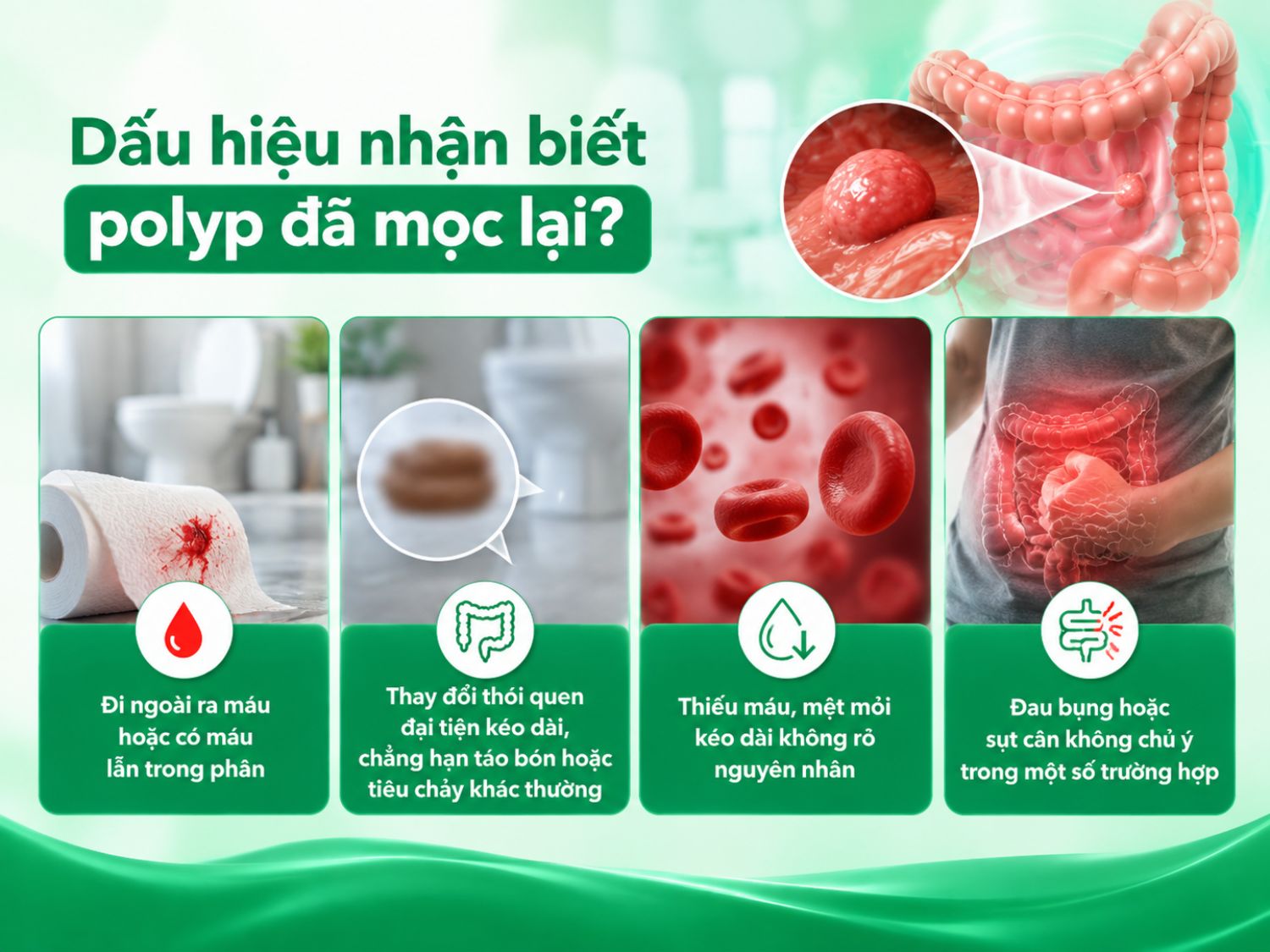 Đi ngoài ra máu, thay đổi thói quen đại tiện, mệt mỏi kéo dài hoặc đau bụng có thể liên quan đến polyp đại tràng và nhiều bệnh lý tiêu hóa khác. Nội soi theo lịch hẹn của bác sĩ là biện pháp quan trọng để phát hiện polyp tái phát, ngay cả khi không có triệu chứng.