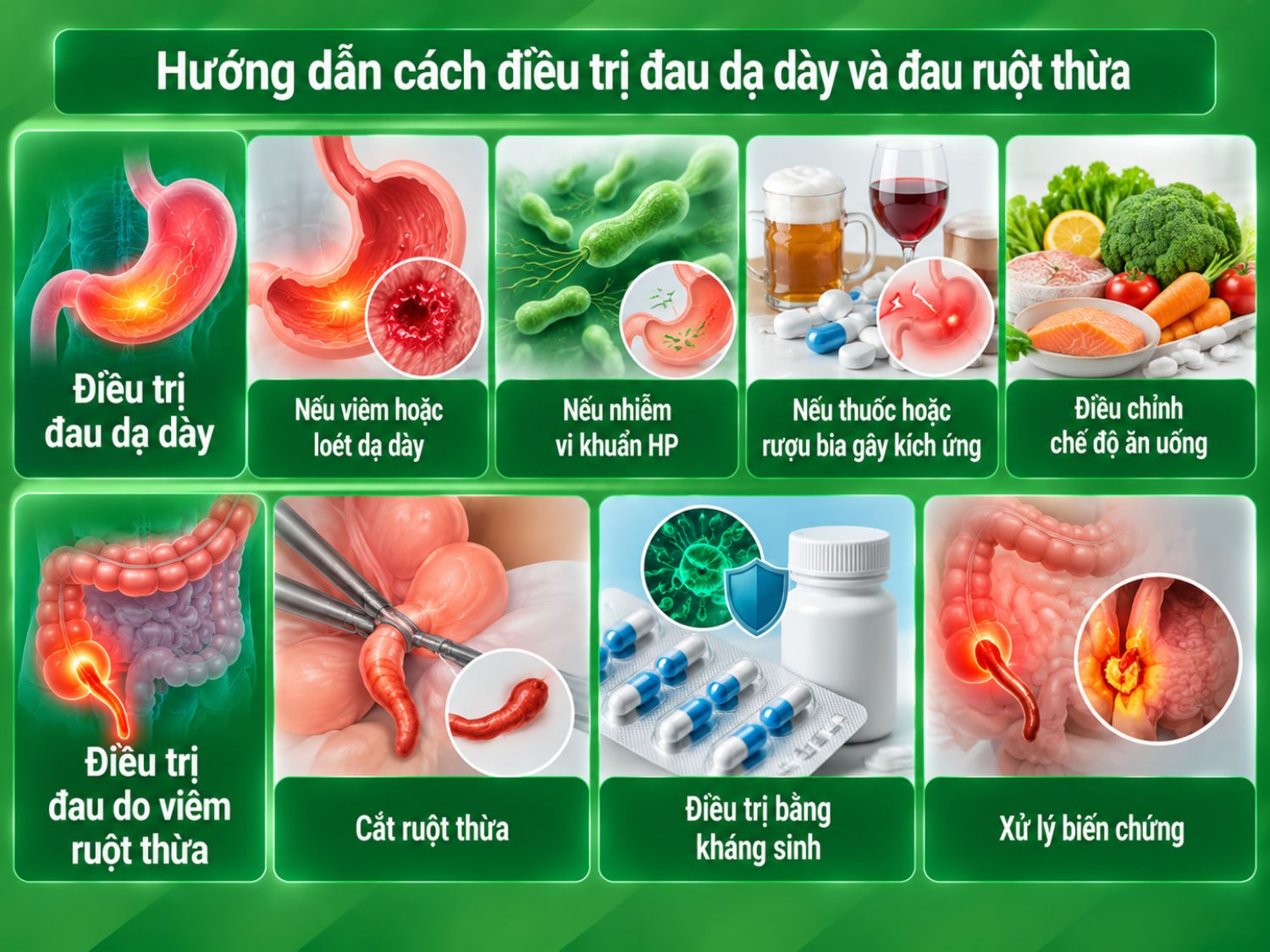 Điều trị đau dạ dày phụ thuộc vào nguyên nhân như viêm loét, nhiễm HP hoặc yếu tố kích ứng; viêm ruột thừa có thể cần phẫu thuật, kháng sinh và xử lý biến chứng tùy tình trạng.