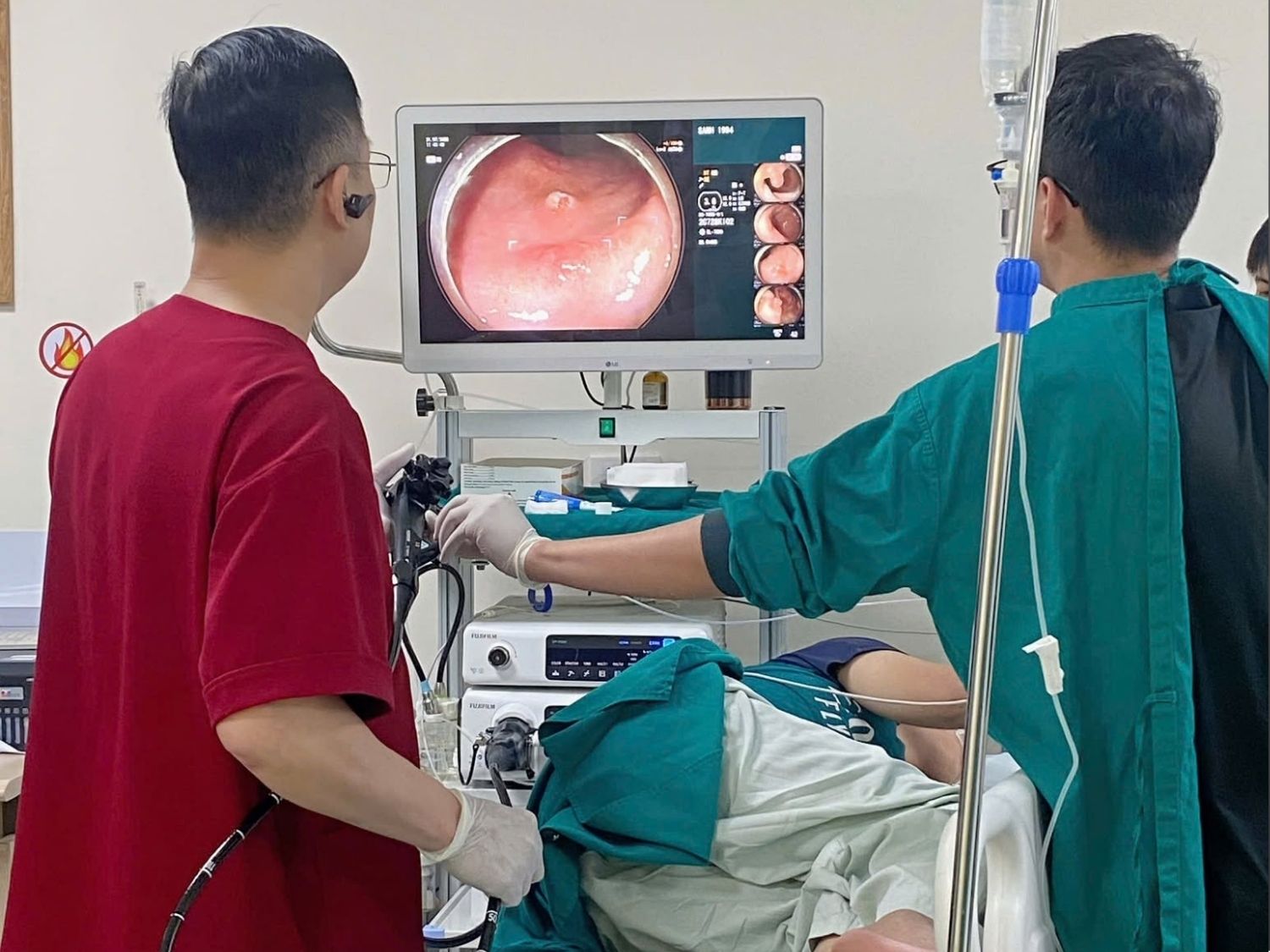 Bác sĩ thực hiện nội soi đại tràng gây mê cho khách hàng