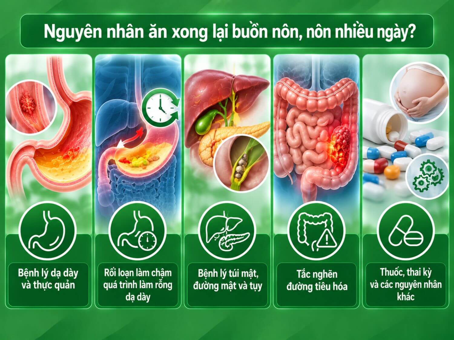 Buồn nôn, nôn nhiều ngày sau ăn có thể liên quan đến bệnh dạ dày – thực quản, chậm làm rỗng dạ dày, bệnh túi mật – tụy, tắc nghẽn tiêu hóa, thuốc, thai kỳ hoặc nguyên nhân khác.