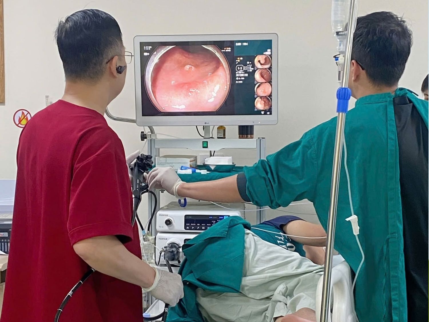 Công nghệ AI trong nội soi đại tràng