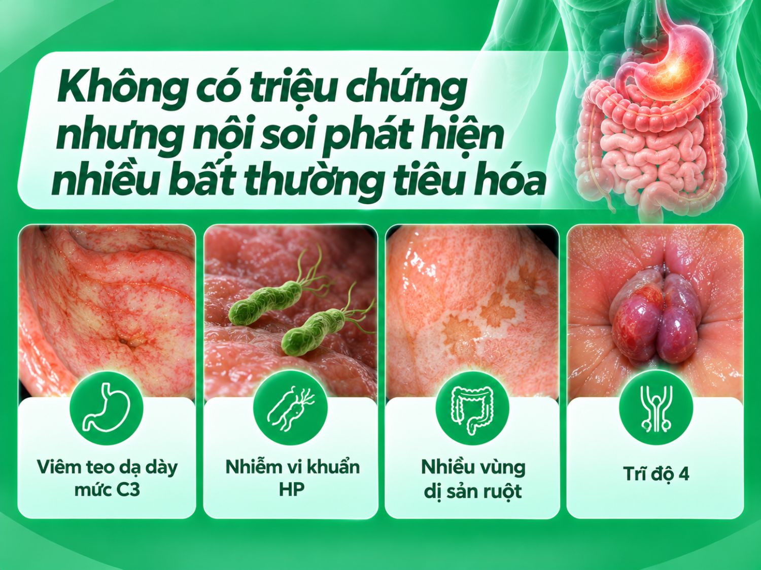 Dù không có triệu chứng rõ ràng, người bệnh vẫn có thể mắc các bệnh lý tiêu hóa như viêm teo dạ dày, nhiễm HP, dị sản ruột hoặc trĩ độ 4. Nội soi theo chỉ định giúp phát hiện các tổn thương, từ đó bác sĩ đánh giá nguy cơ và đưa ra hướng điều trị, theo dõi phù hợp.