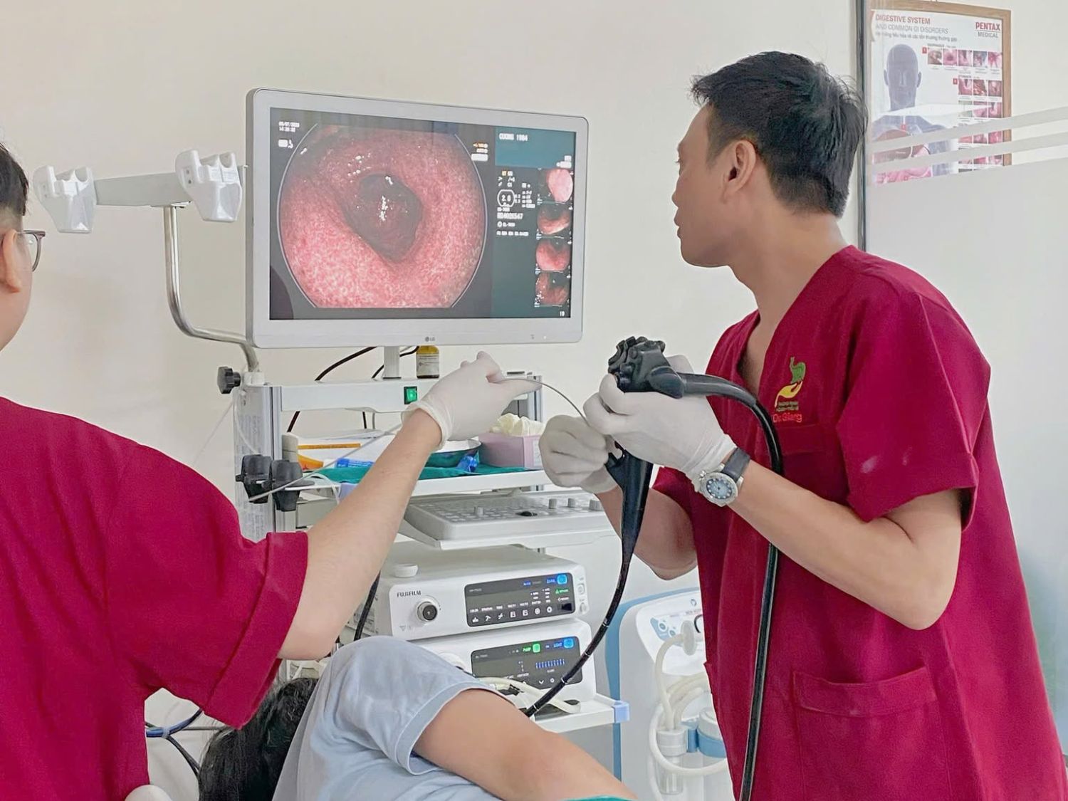 Nội soi tiêu hóa có thể được bác sĩ chỉ định khi cần đánh giá thực quản, dạ dày và tá tràng để tìm nguyên nhân gây buồn nôn, nôn kéo dài.