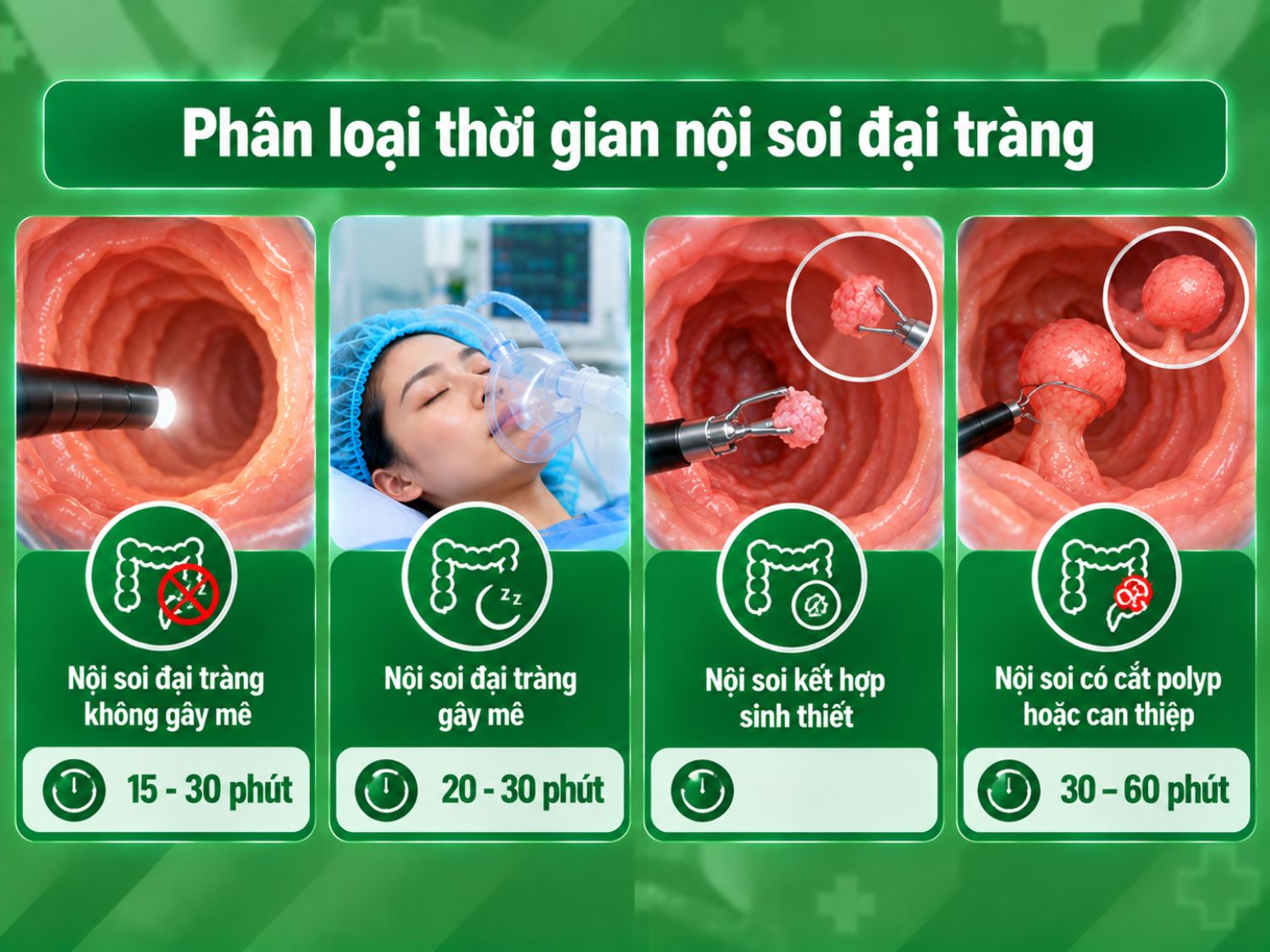 Thời gian nội soi đại tràng thay đổi tùy phương pháp thực hiện và can thiệp đi kèm; trường hợp cắt polyp hoặc cần can thiệp thường mất nhiều thời gian hơn.