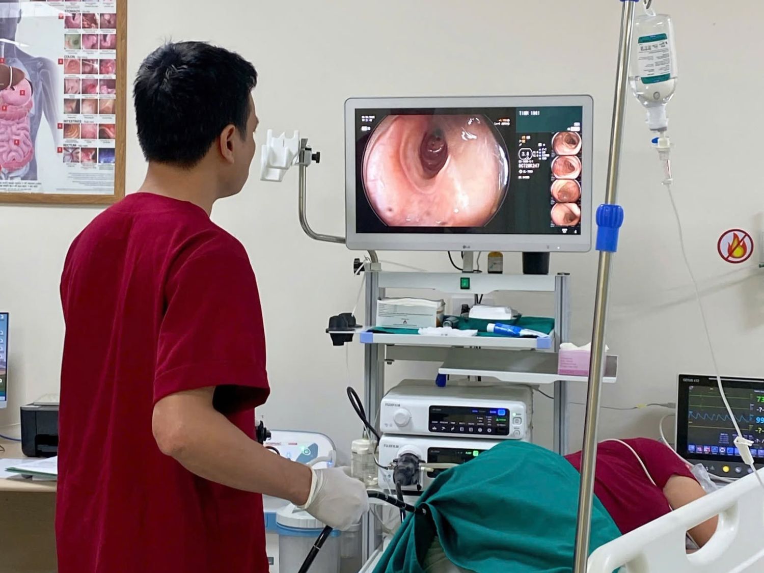 Nội soi đại tràng có hỗ trợ ánh sáng/AI
