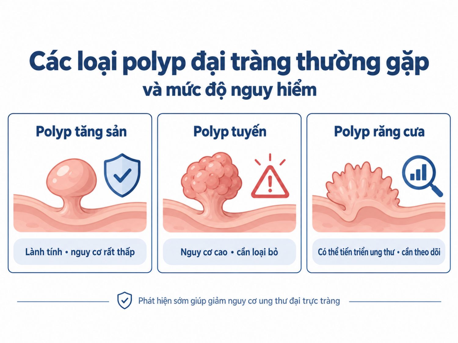 ảnh mô tả Các loại polyp đại tràng thường gặp và mức độ nguy hiểm